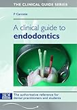 A clinical guide to endodontics