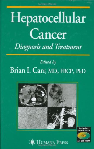Click To Hepatocellular Cancer: Diagnosis and Treatment (Current Clinical Oncology) Details...