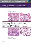 Biopsy interpretation of the prostate