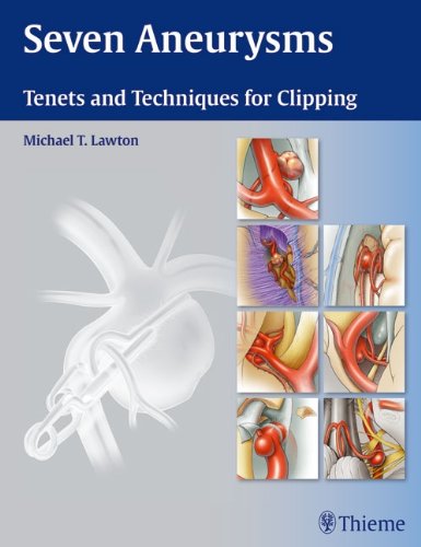 Seven Aneurysms: Tenets and Techniques for Clipping Seven Aneurysms: Tenets and Techniques for Clipping