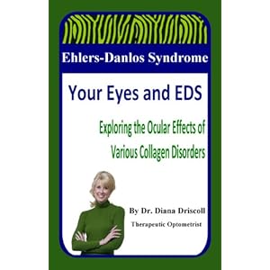 Ehlers-Danlos Syndrome: Your Eyes and EDS