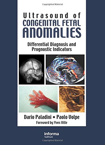 ultrasound of congenital fetal anomalies differential diagnosis and prognostic indicators series in maternal