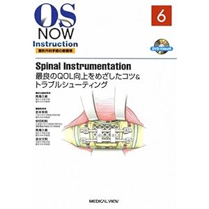 Spinal♪◎Instrumentation−最良のQOL向上をめざしたコツ&トラブルシューティング★☆