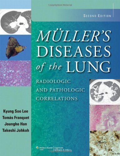 Muller's Diseases of the Lung: Radiologic and Pathologic Correlations Second Edition Muller's Diseases of the Lung: Radiologic and Pathologic Correlations Second Edition