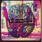 Radiosurgery