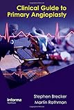 Clinical guide to primary angioplasty