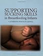 Supporting Sucking Skills in Breastfeeding Infants