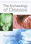 The Archaeology of Disease