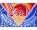 Photographic Print of Artwork of dyspepsia (indigestion) in the stomach from Science Photo Library