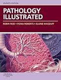 Pathology illustrated