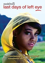 The Last Days of Left Eye