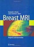 Breast MRI: Diagnosis and Intervention