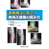 運動療法に役立つ 単純X線像の読み方