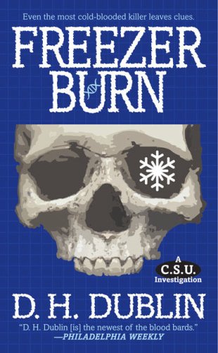 Burns