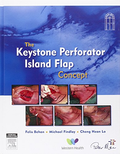 the keystone island flap concept in reconstructive surgery