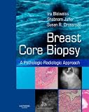 Breast Core Biopsy: A Pathologic-Radiologic Approach
