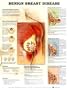 Benign Breast Disease Anatomy Styrene Plastic Chart