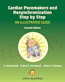 Cardiac pacemakers and resynchronization step by step : an illustrated guide