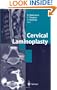 Cervical Laminoplasty