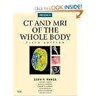 CT and MRI of the Whole Body, 2-Volume Set (Computed Tomography and Magnetic Resonance... by John R. Haaga MD, Vikram S. Dogra MD, Michael Forsting, and Robert C. Gilkeson MD