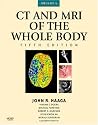 CT and MRI of the Whole Body, 2-Volume Set (Computed Tomography and Magnetic Resonance Imaging of the Whole Body)