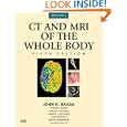 CT and MRI of the Whole Body, 2-Volume Set (Computed Tomography and Magnetic Resonance Imaging of... by John R. Haaga MD, Vikram S. Dogra MD, Michael Forsting, and Robert C. Gilkeson MD