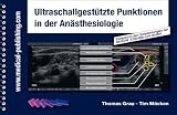 Ultraschallgestützte Punktionen in der Anästhesiologie