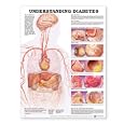 Understanding Diabetes Anatomical Chart by Anatomical Chart Company