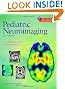 Pediatric Neuroimaging
