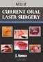 Atlas of Current Oral Laser Surgery