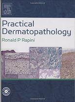 Practical Dermatopathology: Textbook with CD-ROM