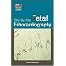 Step-By-Step Fetal Echocardiography
