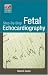 Books : Step-By-Step Fetal Echocardiography