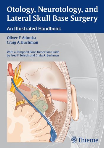 Otology, Neurotology, and Lateral Skull Base Surgery: An Illustrated Handbook