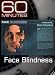 60 Minutes - Face Blindness