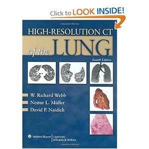 High-Resolution CT of the Lung  - W. Richard Webb