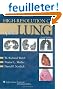 High-Resolution CT of the Lung
