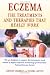 Eczema: The Treatments and Therapies That Really Work