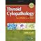 Thyroid cytopathology