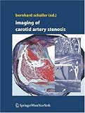 Imaging of Carotid Artery Stenosis