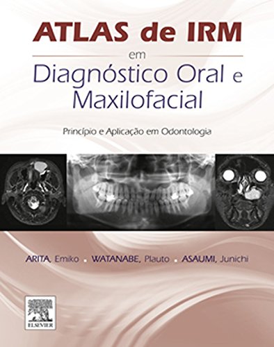 Atlas de IRM em Diagnóstico Oral e Maxilofacial: Princípio e Aplicação em Odontologia (Portuguese Edition)