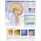 Understanding Sleep Disorders Anatomical Chart
