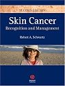 Skin Cancer: Recognition and Management