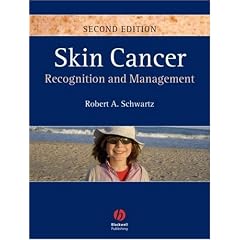 Skin Cancer: Recognition and Management by Robert A. Schwartz