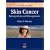 Skin Cancer: Recognition and Management