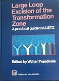 Large loop excision of the transformation zone : a practical guide to LLETZ