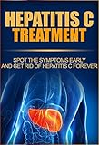 Hepatitis C Treatment: Spot The Symptoms Early And Get Rid Of Hepatitis C Forever (Hepatitis C Transmission, Hepatitis C Cure, Hepatitis C Symptoms ,
