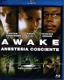 Awake - Anestesia Cosciente