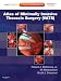 Atlas of Minimally Invasive Thoracic Surgery (VATS): Expert Consult