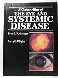 A colour atlas of the eye and systermic disease